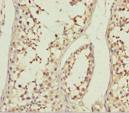 Immunohistochemistry of paraffin-embedded human testis tissue using ABCB8 Antibody at dilution of 1:100