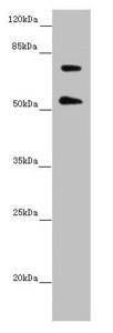Western blot | All lanes: ABCB8 antibody at 2.02 μg/ml |  + Mouse heart tissue | Secondary | Goat polyclonal to rabbit IgG at 1/10000 dilution | Predicted band size: 80, 79, 76, 69, 60 kDa | Observed band size: 80, 55 kDa