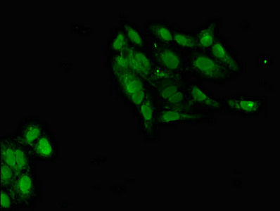 Immunofluorescent analysis of Hela cells using POT1 Antibody at dilution of 1:100 and Alexa Fluor 488-congugated AffiniPure Goat Anti-Rabbit IgG(H+L)Rabbit anti-Human POT1 Polyclonal Antibody