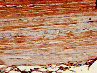 Immunohistochemistry of paraffin-embedded human skeletal muscle tissue using the antibody at dilution of 1:100Rabbit anti-Human POT1 Polyclonal Antibody