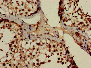 Immunohistochemistry of paraffin-embedded human testis tissue using POT1 Antibody at dilution of 1:100Rabbit anti-Human POT1 Polyclonal Antibody