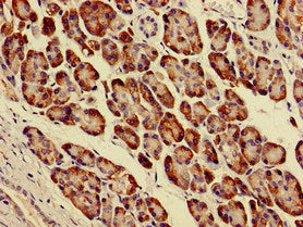 Immunohistochemistry of paraffin-embedded human pancreatic tissue using PARVA Antibody at dilution of 1:100Rabbit anti-Human PARVA Polyclonal Antibody