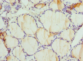 Immunohistochemistry of paraffin-embedded human thyroid tissue using DPP3 Antibody at dilution of 1:100Rabbit anti-Human DPP3 Polyclonal Antibody