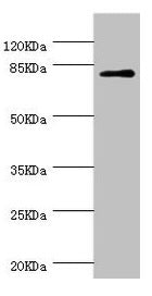 Western blot  | All lanes: DPP3 antibody at 1.39µg/ml + MCF-7 whole cell lysate  | Secondary  | Goat polyclonal to rabbit IgG at 1/10000 dilution  | Predicted band size: 83, 36, 70, 80 kDa  | Observed band size: 83 kDaRabbit anti-Human DPP3 Polyclonal Antibody
