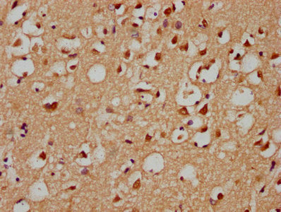 IHC image of GRHL1 Antibody diluted at 1:300 and staining in paraffin-embedded human brain tissue performed on a Leica BondTM system. After dewaxing and hydration, antigen retrieval was mediated by high pressure in a citrate buffer (pH 6.0). Section was blocked with 10% normal goat serum 30min at RT. Then primary antibody (1% BSA) was incubated at 4°C overnight. The primary is detected by a biotinylated secondary antibody and visualized using an HRP conjugated SP system.Rabbit anti-Human GRHL1 Polyclonal Antibody