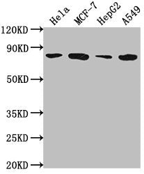 Western Blot | Positive WB detected in: Hela whole cell lysate, MCF-7 whole cell lysate, HepG2 whole cell lysate, A549 whole cell lysate | All lanes: GRHL1 antibody at 1:2000 | Secondary | Goat polyclonal to rabbit IgG at 1/50000 dilution | Predicted band size: 71, 50, 58 kDa | Observed band size: 71 kDaRabbit anti-Human GRHL1 Polyclonal Antibody