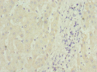 Immunohistochemistry of paraffin-embedded human liver tissue using MTCH1 Antibody at dilution of 1:100