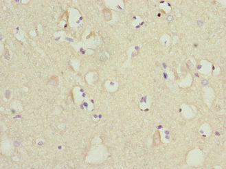 Immunohistochemistry of paraffin-embedded human brain tissue using MTCH1 Antibody at dilution of 1:100