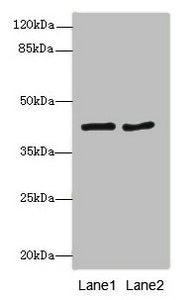 Western blot | All lanes: MTCH1antibody at 2.32μg/ml | Lane 1: MCF-7 whole cell lysate | Lane 2: HepG2 whole cell lysate | Secondary | Goat polyclonal to rabbit IgG at 1/10000 dilution | Predicted band size: 42, 40, 20 kDa | Observed band size: 42 kDa