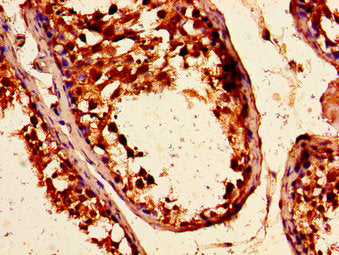 Immunohistochemistry of paraffin-embedded human testis tissue using ARHGEF12 Antibody at dilution of 1:100Rabbit anti-Human ARHGEF12 Polyclonal Antibody