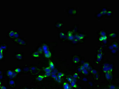 Immunofluorescent analysis of 293T cells using ORMDL1 Antibody at dilution of 1:100 and Alexa Fluor 488-congugated AffiniPure Goat Anti-Rabbit IgG(H+L)Rabbit anti-Human ORMDL1 Polyclonal Antibody