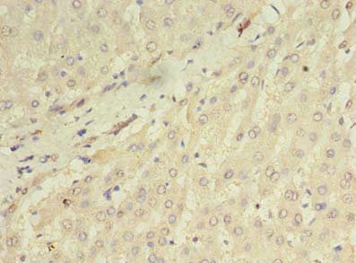 Immunohistochemistry of paraffin-embedded human liver tissue using the antibody at dilution of 1:100Rabbit anti-Human ORMDL1 Polyclonal Antibody