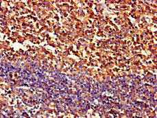 Immunohistochemistry of paraffin-embedded human tonsil tissue using PIPOX Antibody at dilution of 1:100Rabbit anti-Human PIPOX Polyclonal Antibody