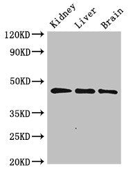 Western Blot | Positive WB detected in: Rat kidney tissue, Rat liver tissue, Mouse brain tissue | All lanes: PIPOX antibody at 2.4μg/ml | Secondary | Goat polyclonal to rabbit IgG at 1/50000 dilution | Predicted band size: 45 kDa | Observed band size: 45 kDaRabbit anti-Human PIPOX Polyclonal Antibody