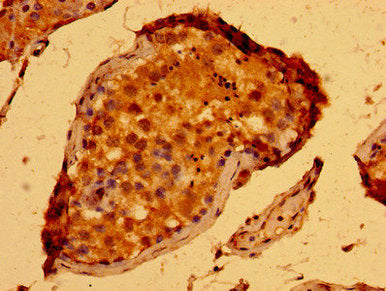 Immunohistochemistry of paraffin-embedded human testis tissue using SEMA5B Antibody at dilution of 1:100