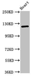 Western Blot | Positive WB detected in: Mouse heart tissue | All lanes: SEMA5B antibody at 1μg/ml | Secondary | Goat polyclonal to rabbit IgG at 1/50000 dilution | Predicted band size: 126, 120, 124, 132 kDa | Observed band size: 126 kDa