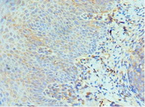 Immunohistochemistry of paraffin-embedded human tonsil tissue using EIF2AK4 Antibody at dilution of 1:100Rabbit anti-Human EIF2AK4 Polyclonal Antibody
