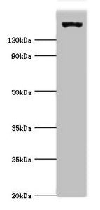 Western blot | All lanes: EIF2AK4 antibody at 2μg/ml + Mouse lung tissue | Secondary | Goat polyclonal to rabbit IgG at 1/10000 dilution | Predicted band size: 187, 184, 70 kDa | Observed band size: 187 kDaRabbit anti-Human EIF2AK4 Polyclonal Antibody