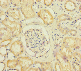 Immunohistochemistry of paraffin-embedded human kidney tissue using SUCLA2 Antibody at dilution of 1:100Rabbit anti-Human SUCLA2 Polyclonal Antibody