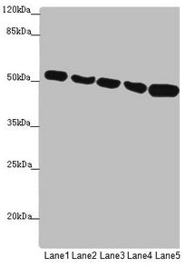 Western blot  | All lanes: SUCLA2 antibody at 1.75µg/ml  | Lane 1: Hela whole cell lysate  | Lane 2: Jurkat whole cell lysate  | Lane 3: A549 whole cell lysate  | Lane 4: 293T whole cell lysate  | Lane 5: HepG2 whole cell lysate  | Secondary  | Goat polyclonal to rabbit IgG at 1/10000 dilution  | Predicted band size: 51, 49 kDa  | Observed band size: 51 kDaRabbit anti-Human SUCLA2 Polyclonal Antibody