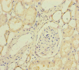 Immunohistochemistry of paraffin-embedded human kidney tissue using SUCLA2 Antibody at dilution of 1:100Rabbit anti-Human SUCLA2 Polyclonal Antibody