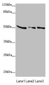 Western blot  | All lanes: SUCLA2 antibody at 0.85µg/ml  | Lane 1: Rat heart tissue  | Lane 2: Hela whole cell lysate  | Lane 3: A549 whole cell lysate  | Secondary  | Goat polyclonal to rabbit IgG at 1/10000 dilution  | Predicted band size: 51, 49 kDa  | Observed band size: 51 kDaRabbit anti-Human SUCLA2 Polyclonal Antibody