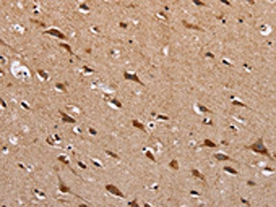 The image on the left is immunohistochemistry of paraffin-embedded Human brain  tissue using HTR3C Antibody(HTR3C Antibody) at dilution 1/30, on the right is treated with fusion protein. (Original magnification: ×200)Rabbit anti-Human HTR3C Polyclonal Antibody