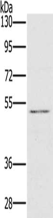 Gel: 8%SDS-PAGE, Lysate: 40 μg, Lane: HT29 cells, Primary antibody: HTR3C Antibody(HTR3C Antibody) at dilution 1/500, Secondary antibody: Goat anti rabbit IgG at 1/8000 dilution, Exposure time: 20 secondsRabbit anti-Human HTR3C Polyclonal Antibody