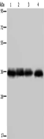 Gel: 8%SDS-PAGE, Lysate: 40 μg, Lane 1-4: K562 cells, human kidney cancer tissue, 293T cells, HepG2 cells, Primary antibody: F11R Antibody(F11R Antibody) at dilution 1/600, Secondary antibody: Goat anti rabbit IgG at 1/8000 dilution, Exposure time: 5 secondsRabbit anti-Human F11R Polyclonal Antibody
