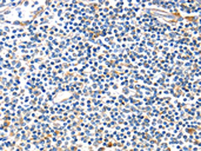 The image on the left is immunohistochemistry of paraffin-embedded Human tonsil tissue using IDE Antibody(IDE Antibody) at dilution 1/20, on the right is treated with fusion protein. (Original magnification: ×200)Rabbit anti-Human IDE Polyclonal Antibody
