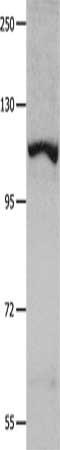 Gel: 8%SDS-PAGE, Lysate: 40 μg, Lane: K652 cells, Primary antibody: IDE Antibody(IDE Antibody) at dilution 1/350, Secondary antibody: Goat anti rabbit IgG at 1/8000 dilution, Exposure time: 40 secondsRabbit anti-Human IDE Polyclonal Antibody