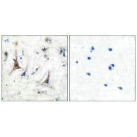 Immunohistochemical analysis of paraffin-embedded human brain tissue using PGP9.5 antibody.Rabbit anti-Human UCHL1 Polyclonal Antibody
