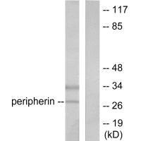 Western blot analysis of extracts from 293 cells, using PGP9.5 antibody.Rabbit anti-Human UCHL1 Polyclonal Antibody