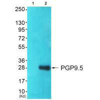Western blot analysis of extracts from 293 cells (Lane 2), using PGP9.5 antiobdy. The lane on the left is treated with systhesized peptide.Rabbit anti-Human UCHL1 Polyclonal Antibody