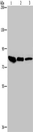 Gel: 6%SDS-PAGE, Lysate: 40 μg, Lane 1-3: Mouse skin tissue, HUVEC cells, Hela cells, Primary antibody: JUP Antibody(JUP Antibody) at dilution 1/850, Secondary antibody: Goat anti rabbit IgG at 1/8000 dilution, Exposure time: 10 seconds