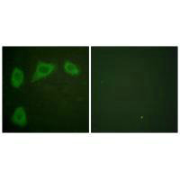 Immunofluorescence analysis of HuvEc cells, using Caveolin-1 antibody.