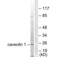 Western blot analysis of extracts from HuvEc cells, using Caveolin-1 antibody.