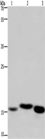 Gel: 10%SDS-PAGE, Lysate: 40 μg, Lane 1-3: Mouse kidney tissue, human fetal liver tissue, mouse liver tissue, Primary antibody: CYB5A Antibody(CYB5A Antibody) at dilution 1/250, Secondary antibody: Goat anti rabbit IgG at 1/8000 dilution, Exposure time: 1 minuteRabbit anti-Human CYB5A Polyclonal Antibody