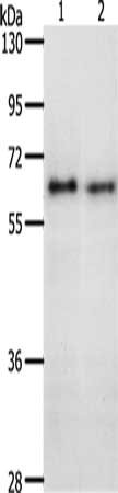 Gel: 10%SDS-PAGE, Lysate: 40 μg, Lane 1-2: K562 cells, 293T cells, Primary antibody: CDC6 Antibody(CDC6 Antibody) at dilution 1/400, Secondary antibody: Goat anti rabbit IgG at 1/8000 dilution, Exposure time: 2 minutesRabbit anti-Human CDC6 Polyclonal Antibody