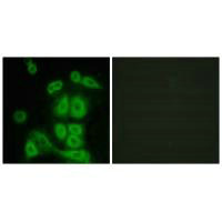 Immunofluorescence analysis of A549 cells, using FXR2 antibody.Rabbit anti-Human FXR2 Polyclonal Antibody