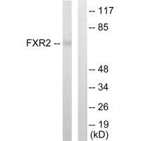 Western blot analysis of extracts from COLO205 cells, using FXR2 antibody.Rabbit anti-Human FXR2 Polyclonal Antibody