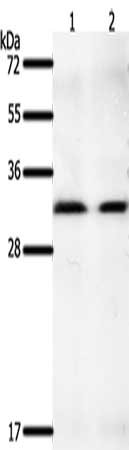 Gel: 10%SDS-PAGE, Lysate: 40 μg, Lane 1-2: K562 cells, hela cells, Primary antibody: GEMIN2 Antibody(GEMIN2 Antibody) at dilution 1/400, Secondary antibody: Goat anti rabbit IgG at 1/8000 dilution, Exposure time: 2 minutesRabbit anti-Human GEMIN2 Polyclonal Antibody