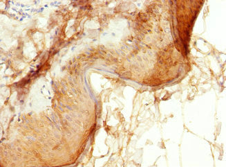 Immunohistochemistry of paraffin-embedded human skin tissue using EPS15L1 Antibody at dilution of 1:100Rabbit anti-Human EPS15L1 Polyclonal Antibody