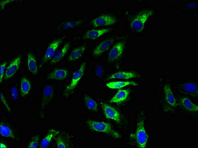 Immunofluorescent analysis of Hela cells using XPR1 Antibody at dilution of 1:100 and Alexa Fluor 488-congugated AffiniPure Goat Anti-Rabbit IgG(H+L)Rabbit anti-Human XPR1 Polyclonal Antibody