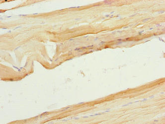 Immunohistochemistry of paraffin-embedded human skeletal muscle tissue using the antibody at dilution of 1:100Rabbit anti-Human XPR1 Polyclonal Antibody