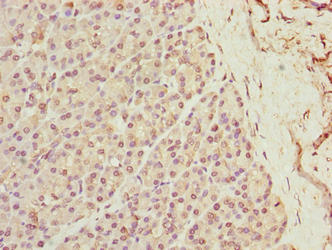 Immunohistochemistry of paraffin-embedded human pancreatic tissue using XPR1 Antibody at dilution of 1:100Rabbit anti-Human XPR1 Polyclonal Antibody