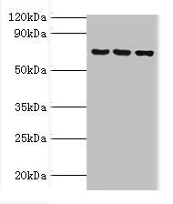 Western blot | All lanes: ABCF2 antibody at 4μg/ml | Lane 1: 293T whole cell lysate | Lane 2: Hela whole cell lysate | Lane 3: NIH/3T3 whole cell lysate | Secondary | Goat polyclonal to rabbit IgG at 1/10000 dilution | Predicted band size: 72, 73 kDa | Observed band size: 72 kDa