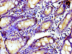 Immunohistochemistry of paraffin-embedded human small intestine tissue using TUBGCP4 Antibody at dilution of 1:100Rabbit anti-Human TUBGCP4 Polyclonal Antibody