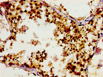 Immunohistochemistry of paraffin-embedded human testis tissue using TUBGCP4 Antibody at dilution of 1:100Rabbit anti-Human TUBGCP4 Polyclonal Antibody