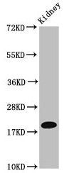 Western Blot  | Positive WB detected in: Mouse kidney tissue  | All lanes: NAA38 antibody at 4µg/ml  | Secondary  | Goat polyclonal to rabbit IgG at 1/50000 dilution  | Predicted band size: 14, 19 kDa  | Observed band size: 19 kDaRabbit anti-Human NAA38 Polyclonal Antibody
